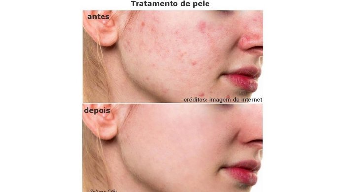 Fazer o tratamento de pele das fotos
Pacote 10 fotos R$ 280,00 Entonz Freelancer